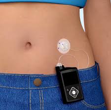 Medtronic Insulin Pump 700
